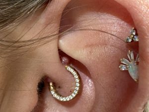 industrial piercing infection bump